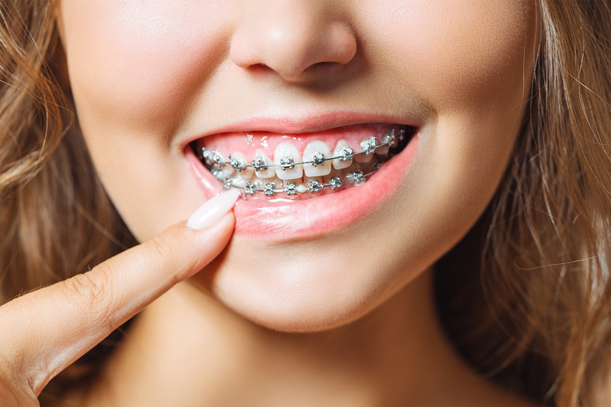 Orthodontics - Dental Braces Clinic