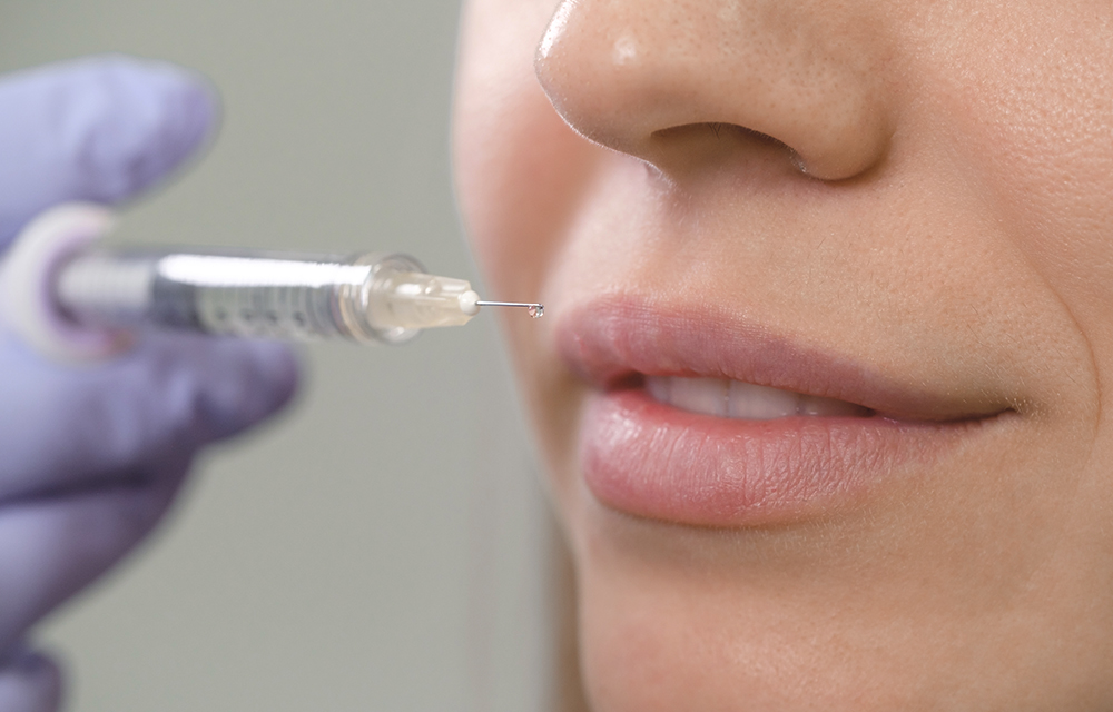 hyaluronic lip injections